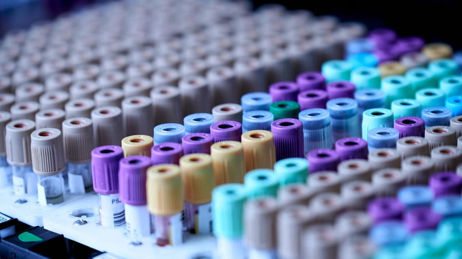 The synergistic potential of Tesamorelin and Ipamorelin peptide blend in research tesamorelin Partner Spotlight