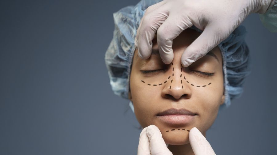 Understanding the procedure with our FAQ about aesthetic rhinoplasty surgery rhinoplasty Partner Spotlight