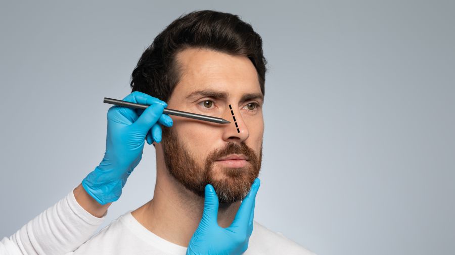 Understanding the procedure with our FAQ about aesthetic rhinoplasty surgery rhinoplasty Partner Spotlight