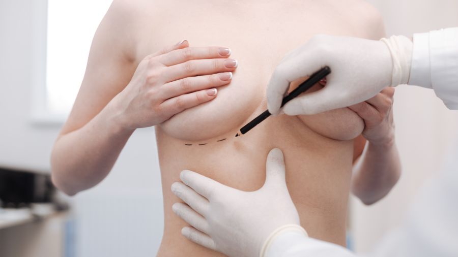 What to expect during your first breast augmentation consultation breast Partner Spotlight